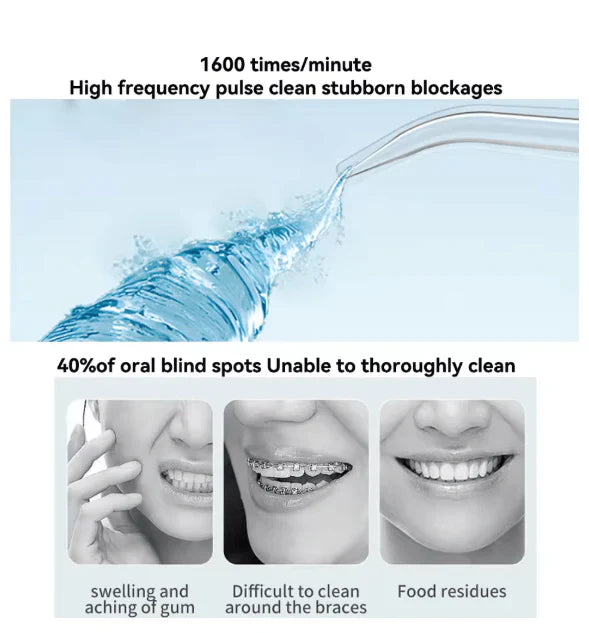 Gulf Smile High-Pressure Oral Irrigator for UAE’s Modern Lifestyle